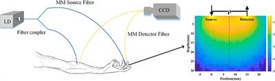 In Vivo Pulse Wave Measurement Through a Multimode Fiber Diffuse Speckle Analysis System